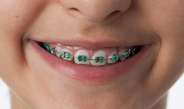 Orthodontics