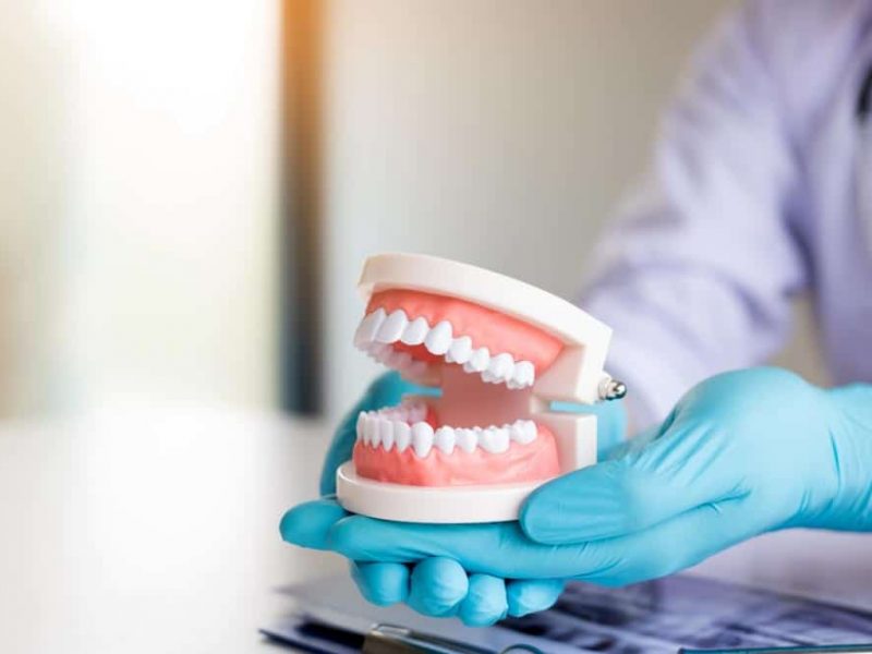 Dentist holding dentures in office room